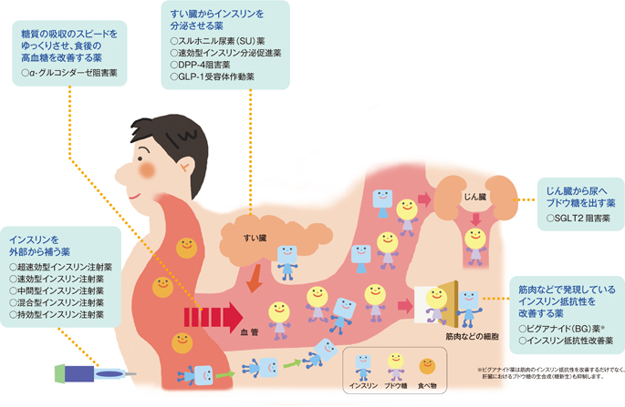 糖尿病の飲み薬