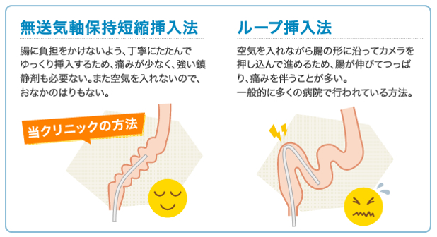 無送気軸保持短縮挿入法って何？