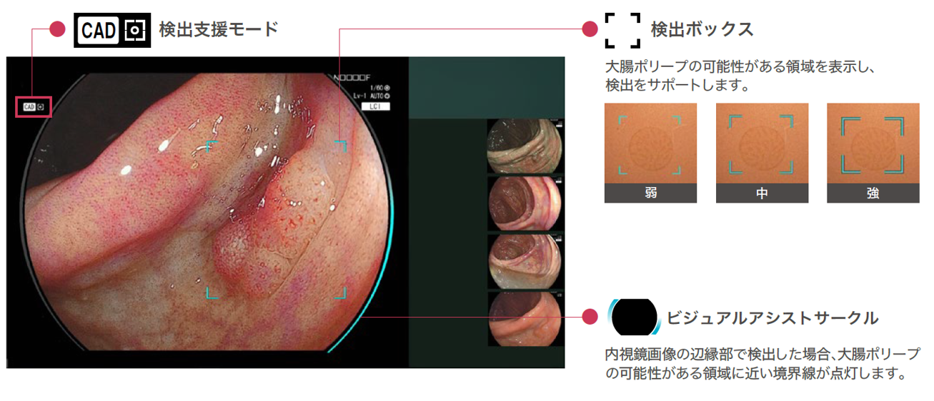 病変検出支援機能