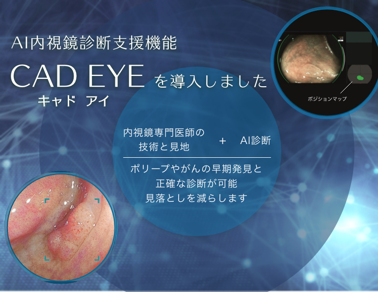 AI内視鏡診断支援機能　CAD EYEを導入しました キャッドアイ